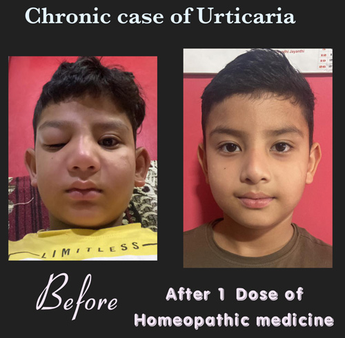 17-15-After-Before-1