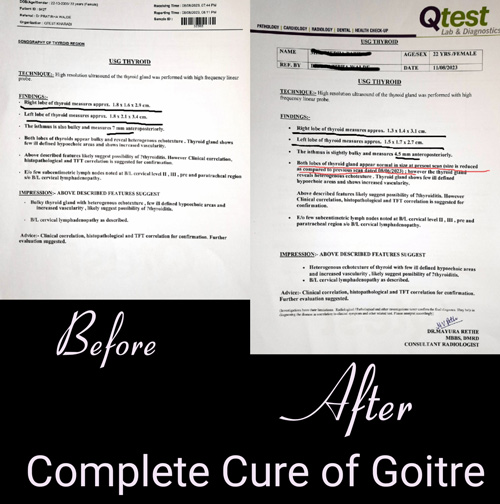 17-15-After-Before-2