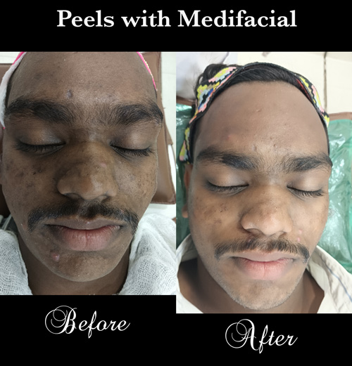 17-15-After-Before-3