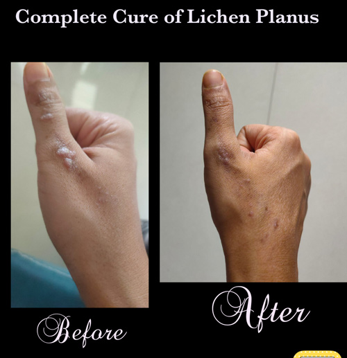 17-15-After-Before-4